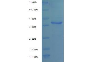SDS-PAGE (SDS) image for Interleukin 2 (IL2) (AA 21-153) protein (GST tag) (ABIN5709741)