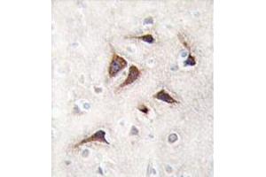 Formalin-fixed and paraffin-embedded human brain tissue reacted with CAMK2 delta Antibody (C-term) , which was peroxidase-conjugated to the secondary antibody, followed by DAB staining. (CAMK2D Antikörper  (C-Term))