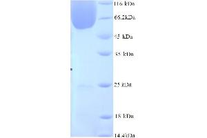 SDS-PAGE (SDS) image for BCL2-Associated Athanogene 3 (BAG3) (AA 2-577) protein (His tag) (ABIN5714470)