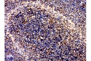 Immunohistochemistry (Paraffin-embedded Sections) (IHC (p)) image for anti-Interleukin 1 Receptor, Type I (IL1R1) (AA 481-569) antibody (ABIN747743)