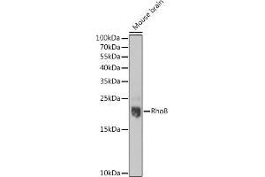 Western blot analysis of extracts of Mouse brain, using RhoB pAb  at 1:1000 dilution. (RHOB Antikörper  (C-Term))