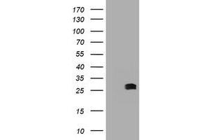 Image no. 2 for anti-B-Cell CLL/lymphoma 10 (BCL10) antibody (ABIN1496848) (BCL10 Antikörper)