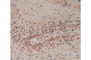 Figure. (FADD Antikörper  (AA 12-206))