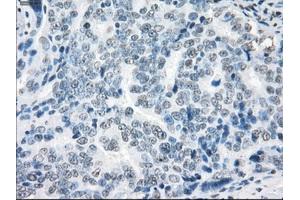 Immunohistochemical staining of paraffin-embedded colon tissue using anti-XRCC4mouse monoclonal antibody. (XRCC4 Antikörper)