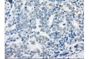 Immunohistochemical staining of paraffin-embedded colon tissue using anti-XRCC4mouse monoclonal antibody.