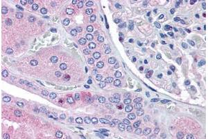 Human Kidney (formalin-fixed, paraffin-embedded) stained with RNF213 antibody ABIN290197 at 2. (RNF213 Antikörper  (AA 5244-5254))