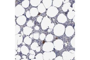 Immunohistochemical staining (Formalin-fixed paraffin-embedded sections) of human bone marrow with LILRA4 polyclonal antibody  shows strong cytoplasmic positivity in hematopoietic cells / megakaryocytes. (LILRA4 Antikörper  (AA 159-211))