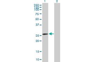 Western Blot analysis of AK2 expression in transfected 293T cell line by AK2 MaxPab polyclonal antibody. (Adenylate Kinase 2 Antikörper  (AA 1-239))