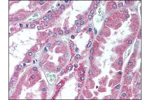 Image no. 1 for anti-Collagen, Type XVIII, alpha 1 (COL18A1) (C-Term), (Chain alpha 1) antibody (ABIN372488)