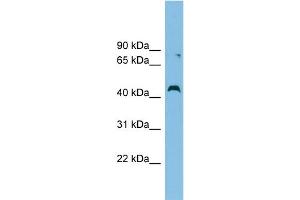 WB Suggested Anti-CCBE1 Antibody Titration: 0. (CCBE1 Antikörper  (Middle Region))