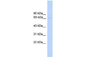 WB Suggested Anti-PAntibody Titration:  0. (PARP6 Antikörper  (N-Term))