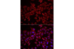 Immunofluorescence analysis of HeLa cell using CSRP3 antibody. (CSRP3 Antikörper)