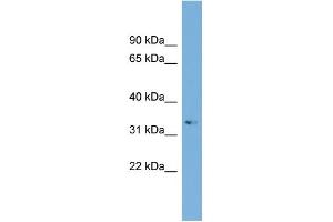 WB Suggested Anti-ARL13B Antibody Titration: 0. (ARL13B Antikörper  (Middle Region))