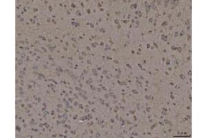 IHC analysis of Calnexin/CANX using anti-Calnexin/CANX antibody (ABIN7602289).