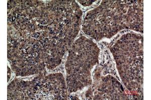 Immunohistochemistry (IHC) analysis of paraffin-embedded Human Lung, antibody was diluted at 1:100.