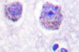Image no. 1 for anti-Ribosomal Protein S6 Kinase, 70kDa, Polypeptide 1 (RPS6KB1) antibody (ABIN272052) (RPS6KB1 Antikörper)