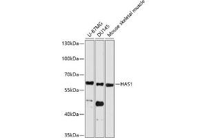 Western blot analysis of extracts of various cell lines, using H antibody (ABIN6129577, ABIN6141611, ABIN6141612 and ABIN6214712) at 1:1000 dilution. (HAS1 Antikörper  (AA 80-390))