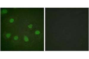 Immunofluorescence analysis of HeLa cells, using Retinoblastoma (Ab-249) Antibody. (Retinoblastoma Protein (Rb) Antikörper  (AA 211-260))