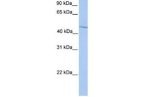 WB Suggested Anti-HOXA13 Antibody Titration: 0. (HOXA13 Antikörper  (Middle Region))