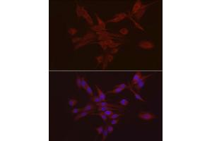 Immunofluorescence analysis of PC-12 using S100 antibody (ABIN7270123) at dilution of 1:25 (40x lens). (S100A10 Antikörper  (AA 1-97))