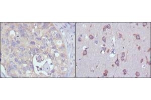 Immunohistochemical analysis of paraffin-embedded human lung cancer (left) and human brain (right) tissues using MPS1 mouse mAb with DAB staining.