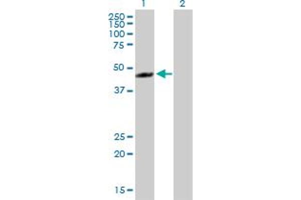 RECQL5 Antikörper  (AA 1-435)