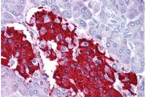 Immunohistochemistry (Formalin-fixed Paraffin-embedded Sections) (IHC (fp)) image for anti-Leptin (LEP) (C-Term) antibody (ABIN604739)