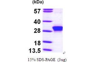 SDS-PAGE (SDS) image for rho Family GTPase 3 (RND3) (AA 1-241) protein (His tag) (ABIN667167)