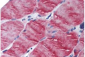 Human Skeletal Muscle (formalin-fixed, paraffin-embedded) stained with MYO5B antibody ABIN305726 at 2. (MYO5B Antikörper  (N-Term))