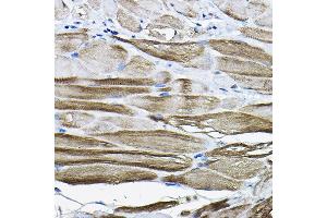 Immunohistochemistry (IHC) image for anti-LIM Domain Binding 3 (LDB3) (AA 1-283) antibody (ABIN6143125)