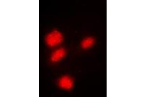 Immunofluorescent analysis of CREB staining in Hela cells. (CREB1 Antikörper  (Center))