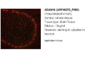 Image no. 2 for anti-ADAM Metallopeptidase Domain 15 (ADAM15) (Middle Region) antibody (ABIN405816) (ADAM15 Antikörper  (Middle Region))