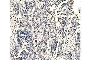 IHC analysis of KI/VIRMA using anti-KI/VIRMA antibody (ABIN7599707). (Protein Virilizer Homolog (VIRMA) (AA 11-1529) Antikörper)