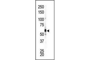 Image no. 4 for anti-Gardner-Rasheed Feline Sarcoma Viral (V-Fgr) Oncogene Homolog (FGR) (AA 11-40), (N-Term) antibody (ABIN359981)