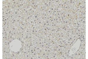 ABIN6274798 at 1/100 staining Mouse liver tissue by IHC-P. (ACSS1 Antikörper  (C-Term))