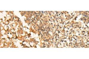 Immunohistochemistry of paraffin-embedded Human tonsil tissue using CEP57 Polyclonal Antibody at dilution of 1:30(x200) (CEP57 Antikörper)