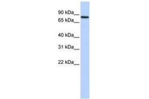 Image no. 1 for anti-Adenosine Deaminase, RNA-Specific, B2 (ADARB2) (AA 612-661) antibody (ABIN6740701) (ADARB2 Antikörper  (AA 612-661))