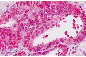 Human Prostate: Formalin-Fixed, Paraffin-Embedded (FFPE) (STAT2 Antikörper  (C-Term))