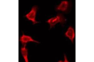 ABIN6276197 staining HeLa by IF/ICC. (OR9Q2 Antikörper  (C-Term))