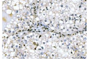 IHC analysis of GADD45B using anti-GADD45B antibody (ABIN7603219). (GADD45B Antikörper  (N-Term))