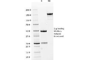 SDS-PAGE Analysis Purified RCC Mouse Monoclonal Antibody (66. (CA9 Antikörper)