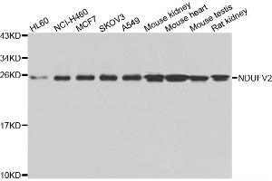 Western blot analysis of extracts of various cell lines, using NDUFV2 antibody (ABIN5975536) at 1/1000 dilution. (NDUFV2 Antikörper)