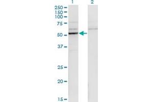 Western Blot analysis of CYP26B1 expression in transfected 293T cell line by CYP26B1 monoclonal antibody (M01), clone 1H6. (CYP26B1 Antikörper  (AA 131-230))