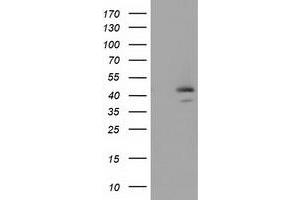 Image no. 1 for anti-serpin Peptidase Inhibitor, Clade B (Ovalbumin), Member 4 (SERPINB4) antibody (ABIN1500890) (SERPINB4 Antikörper)