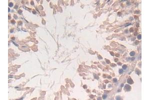Immunohistochemistry (IHC) image for anti-Cytoglobin (CYGB) (AA 1-190) antibody (ABIN7434902)
