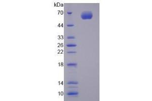 Image no. 1 for Cytochrome P450, Family 1, Subfamily A, Polypeptide 1 (CYP1A1) (AA 251-521) (Active) protein (His tag,GST tag) (ABIN6239867) (CYP1A1 Protein (AA 251-521) (His tag,GST tag))