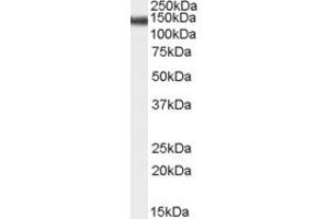 Western Blotting (WB) image for anti-Abhydrolase Domain Containing 17C (ABHD17C) (Middle Region) antibody (ABIN2791515) (ABHD17C Antikörper  (Middle Region))