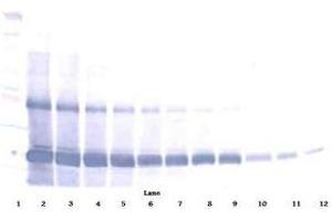 Image no. 3 for anti-AIMP1 / EMAP II antibody (ABIN465271) (AIMP1 / EMAP II Antikörper)