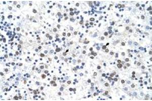 Immunohistochemical staining (Formalin-fixed paraffin-embedded sections) of human liver with FECH polyclonal antibody  at 4-8 ug/mL working concentration. (FECH Antikörper  (N-Term))