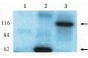 Western blot analysis using anti-Lfc antibody on HEK-293 cell transfected with vector alone (1), lfc-short (2) and lfc-long (3). (ARHGEF2 Antikörper)